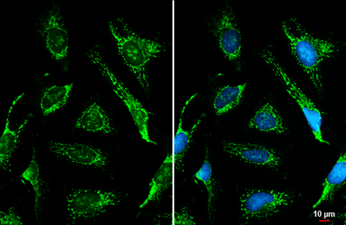 Anti-ACADVL antibody [N1C1] used in Immunocytochemistry/ Immunofluorescence (ICC/IF). GTX114232