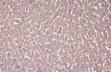 Anti-ACADVL antibody [N1C1] used in IHC (Paraffin sections) (IHC-P). GTX114232
