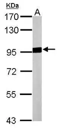 Anti-Aconitase 2 antibody [N1N3] used in Western Blot (WB). GTX114233