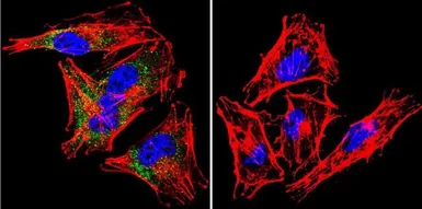 Anti-SNTB2 antibody [1351] used in Immunocytochemistry/ Immunofluorescence (ICC/IF). GTX11425