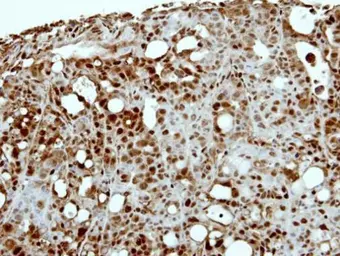 Anti-CAPG antibody [N3C3] used in IHC (Paraffin sections) (IHC-P). GTX114301
