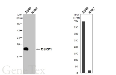 Anti-CSRP1 antibody [N1C3] used in Western Blot (WB). GTX114344