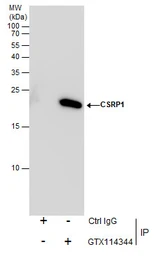 Anti-CSRP1 antibody [N1C3] used in Immunoprecipitation (IP). GTX114344