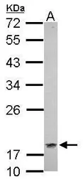 Anti-CSRP1 antibody [N1C3] used in Western Blot (WB). GTX114344