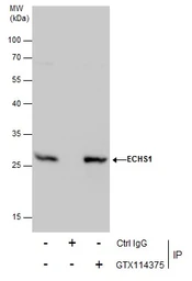 Anti-ECHS1 antibody used in Immunoprecipitation (IP). GTX114375