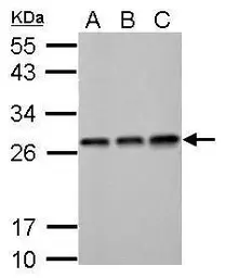 Anti-ECHS1 antibody used in Western Blot (WB). GTX114375