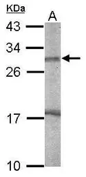 Anti-EndoG antibody [N1C3] used in Western Blot (WB). GTX114385