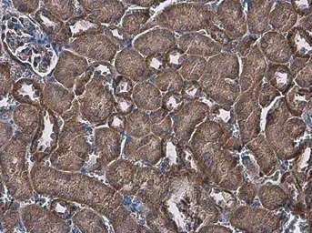 Anti-FACL4 antibody [N1N3] used in IHC (Paraffin sections) (IHC-P). GTX114399