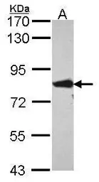 Anti-FACL4 antibody [N1N3] used in Western Blot (WB). GTX114399