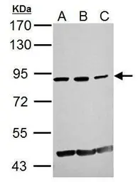 Anti-GCN5 antibody [C2C3], C-term used in Western Blot (WB). GTX114428