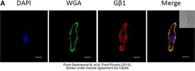 Anti-GNB1 antibody used in Immunocytochemistry/ Immunofluorescence (ICC/IF). GTX114442