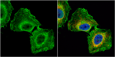 Anti-GNB1 antibody used in Immunocytochemistry/ Immunofluorescence (ICC/IF). GTX114442