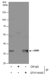Anti-GNB1 antibody used in Immunoprecipitation (IP). GTX114442