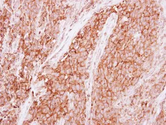 Anti-GNB1 antibody used in IHC (Paraffin sections) (IHC-P). GTX114442