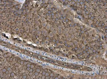 Anti-GNB1 antibody used in IHC (Paraffin sections) (IHC-P). GTX114442