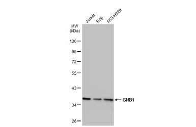 Anti-GNB1 antibody used in Western Blot (WB). GTX114442