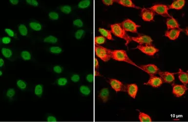 Anti-Histone H1.0 antibody used in Immunocytochemistry/ Immunofluorescence (ICC/IF). GTX114462