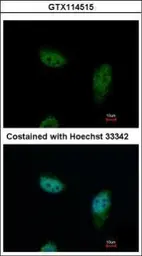 Anti-IPO5 antibody [N1N2], N-term used in Immunocytochemistry/ Immunofluorescence (ICC/IF). GTX114515