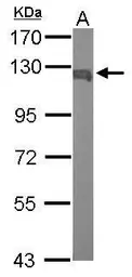 Anti-IPO5 antibody [N1N2], N-term used in Western Blot (WB). GTX114515