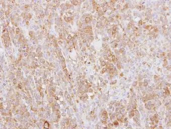Anti-L-Plastin antibody [C1C3] used in IHC (Paraffin sections) (IHC-P). GTX114524