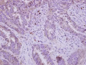 Anti-FADS1 antibody used in IHC (Paraffin sections) (IHC-P). GTX114528