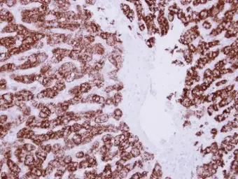 Anti-ALDH6A1 antibody used in IHC (Paraffin sections) (IHC-P). GTX114553