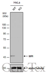 Anti-MPI antibody used in Western Blot (WB). GTX114555