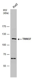 Anti-TRIM37 antibody [N1N2], N-term used in Western Blot (WB). GTX114565