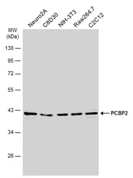 Anti-PCBP2 antibody [N1C1] used in Western Blot (WB). GTX114616