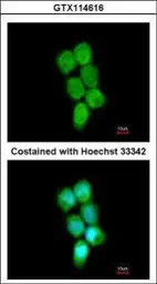 Anti-PCBP2 antibody [N1C1] used in Immunocytochemistry/ Immunofluorescence (ICC/IF). GTX114616