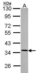 Anti-PPP4C antibody used in Western Blot (WB). GTX114659