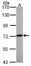 Anti-Arginyl tRNA synthetase antibody [N2C2], Internal used in Western Blot (WB). GTX114704