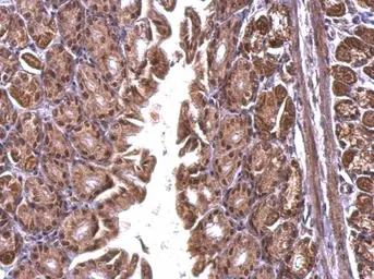 Anti-TRA2B antibody used in IHC (Paraffin sections) (IHC-P). GTX114752