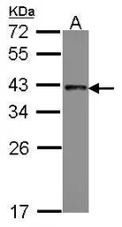 Anti-TRA2B antibody used in Western Blot (WB). GTX114752