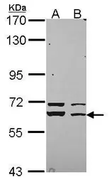 Anti-Munc18-1 antibody used in Western Blot (WB). GTX114809