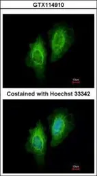 Anti-EIF4A1 antibody [N2C2], Internal used in Immunocytochemistry/ Immunofluorescence (ICC/IF). GTX114910