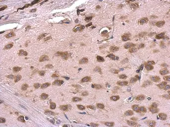 Anti-RPL6 antibody used in IHC (Paraffin sections) (IHC-P). GTX114913