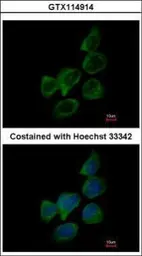 Anti-Aldolase B antibody used in Immunocytochemistry/ Immunofluorescence (ICC/IF). GTX114914