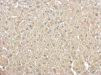 Anti-Aldolase B antibody used in IHC (Paraffin sections) (IHC-P). GTX114914