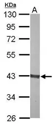 Anti-Aldolase B antibody used in Western Blot (WB). GTX114914