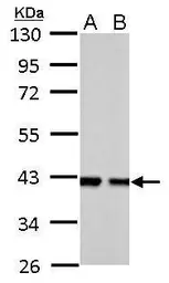 Anti-Aldolase B antibody used in Western Blot (WB). GTX114914