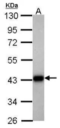 Anti-Aldolase B antibody used in Western Blot (WB). GTX114914