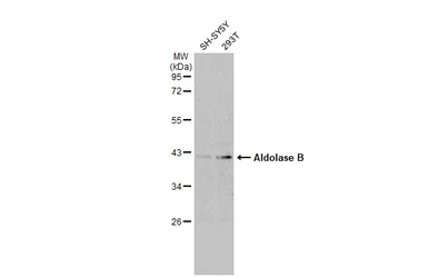 Anti-Aldolase B antibody used in Western Blot (WB). GTX114914