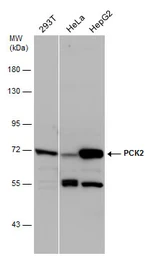 Anti-PCK2 antibody used in Western Blot (WB). GTX114919