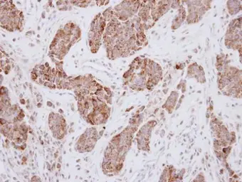 Anti-PCK2 antibody used in IHC (Paraffin sections) (IHC-P). GTX114919