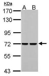 Anti-PCK2 antibody used in Western Blot (WB). GTX114919
