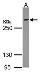 Anti-HCF1 antibody [N1], N-term used in Western Blot (WB). GTX114922