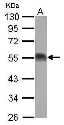 Anti-EIF5 antibody used in Western Blot (WB). GTX114923