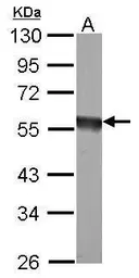 Anti-EIF5 antibody used in Western Blot (WB). GTX114923