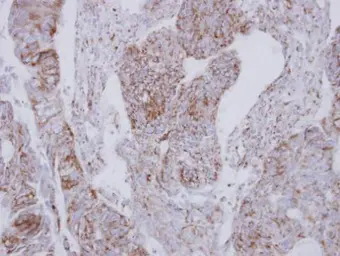 Anti-NDUFS2 antibody used in IHC (Paraffin sections) (IHC-P). GTX114924